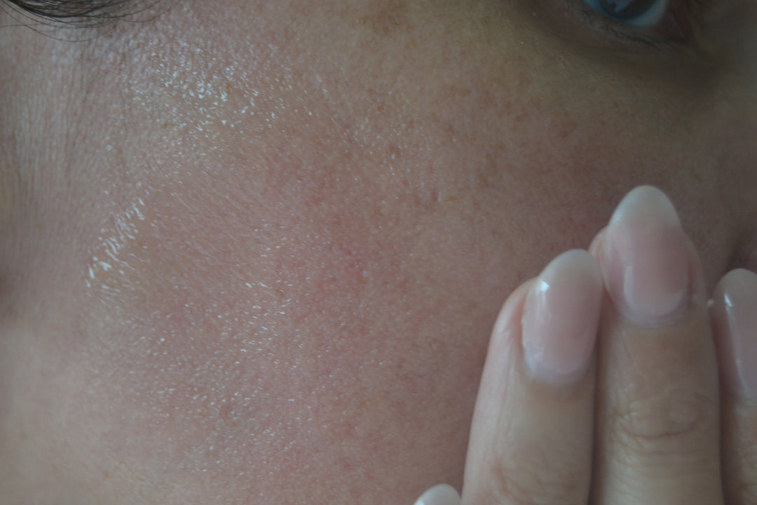 Model blending Cx3 Gold Serum into face by EMK Skincare