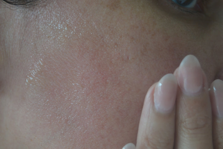 Model blending Cx3 Gold Serum into face by EMK Skincare